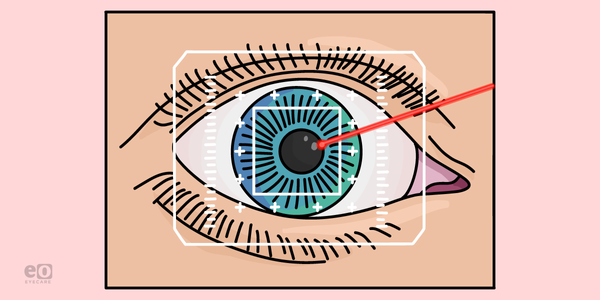 Real-World LASIK Candidacy: Myth-Busting for Ophthalmology Residents