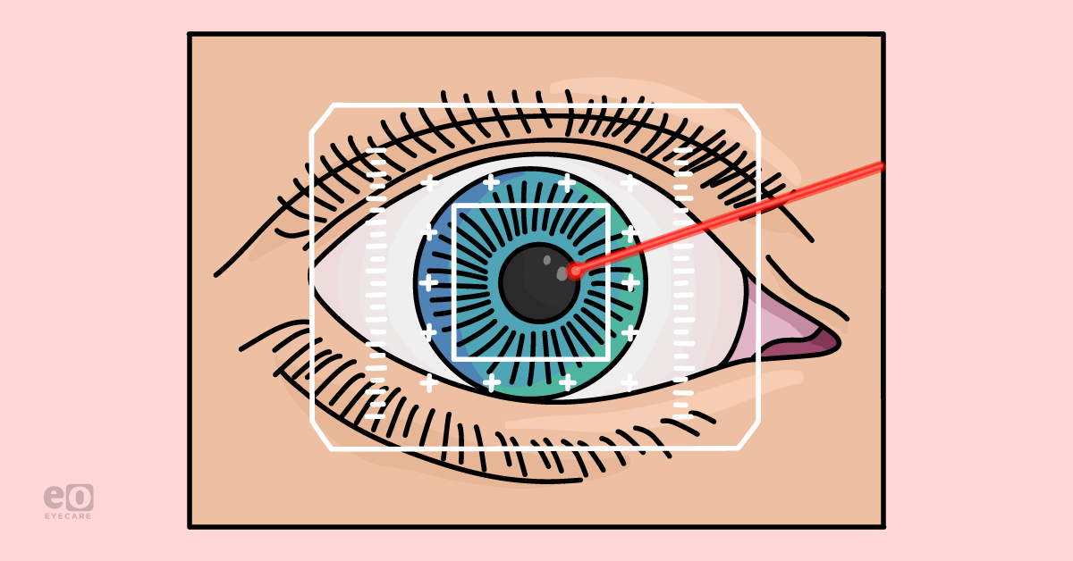 Real-World LASIK Candidacy: Myth-Busting for Ophthalmology Residents