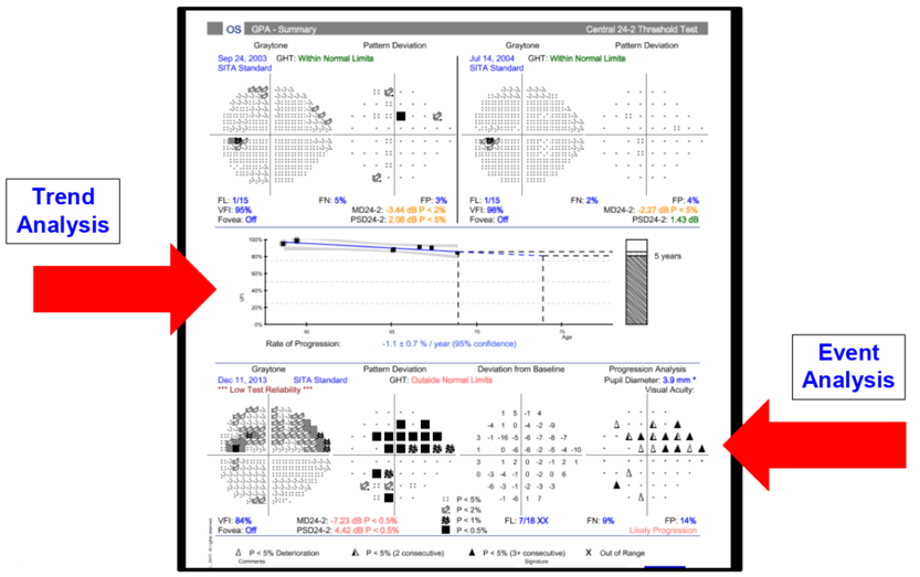 Figure 5. The HFA GPA report for the left eye. The first two baseline tests are shown at the top and the most recent test is shown at the bottom. The VFI plot in the middle is developed by the trend analysis. The event analysis is in the lower right corner.