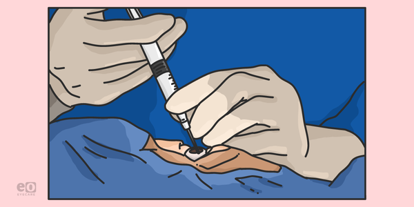 Dry AMD Treatments: An Ophthalmology Resident's Guide