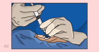 Dry AMD Treatments: An Ophthalmology Resident's Guide