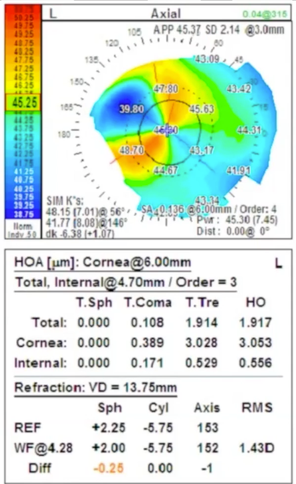 Corneal topography axis flip