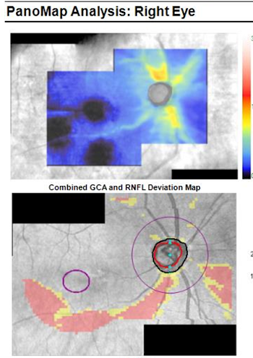 Panomap analysis