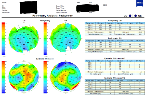 Pachymetry Analysis