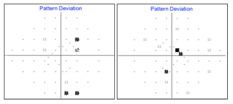 Pattern Deviation