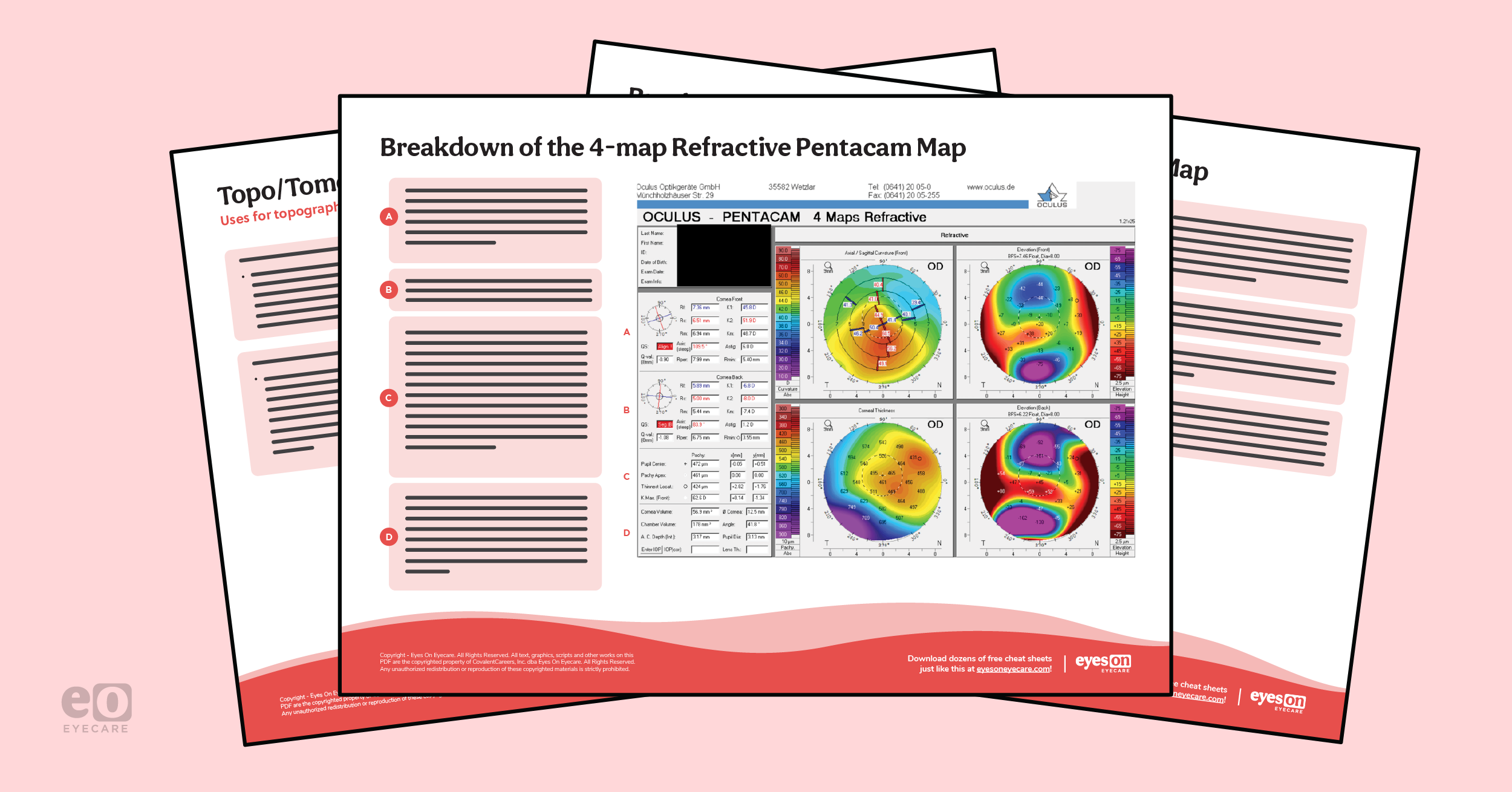 A Guide to Corneal Topography with Cheat Sheet