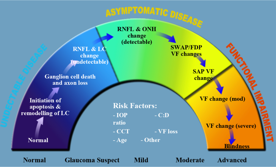 Figure 1. The Glaucoma Continuum presented in an article by Dr. Weinreb and colleagues in the American Journal of Ophthalmology (Vol 138 Issue 3 Sept. 2004) shows the progression of glaucoma from undetectable to asymptomatic to functional impairment.