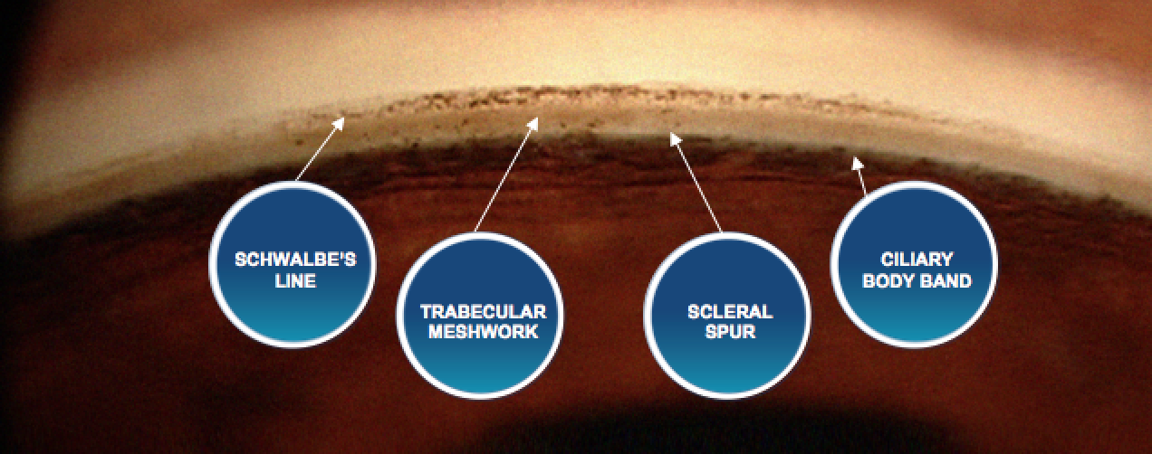 Angle anatomical structures gonioscopy