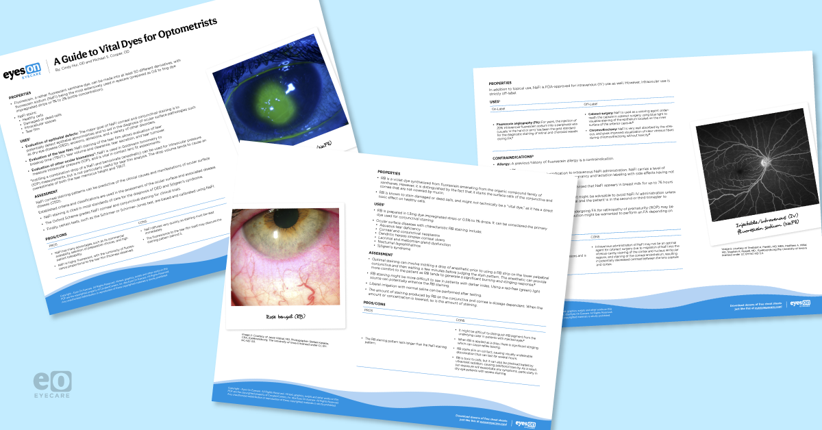 True Colors: What Dyes Reveal in Ocular Disease with Cheat Sheet