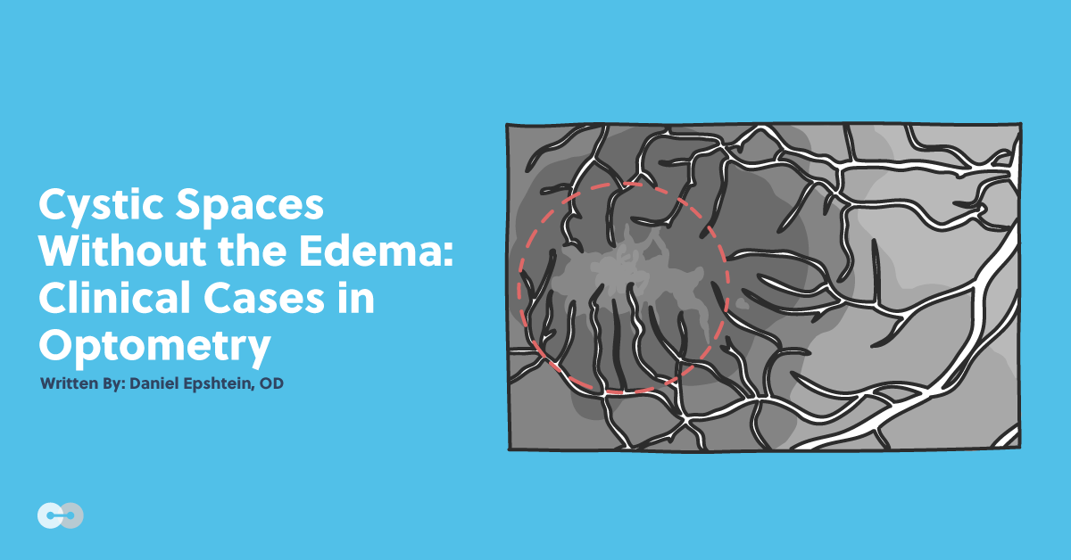 Cystic Spaces Without the Edema: Clinical Cases in Optometry