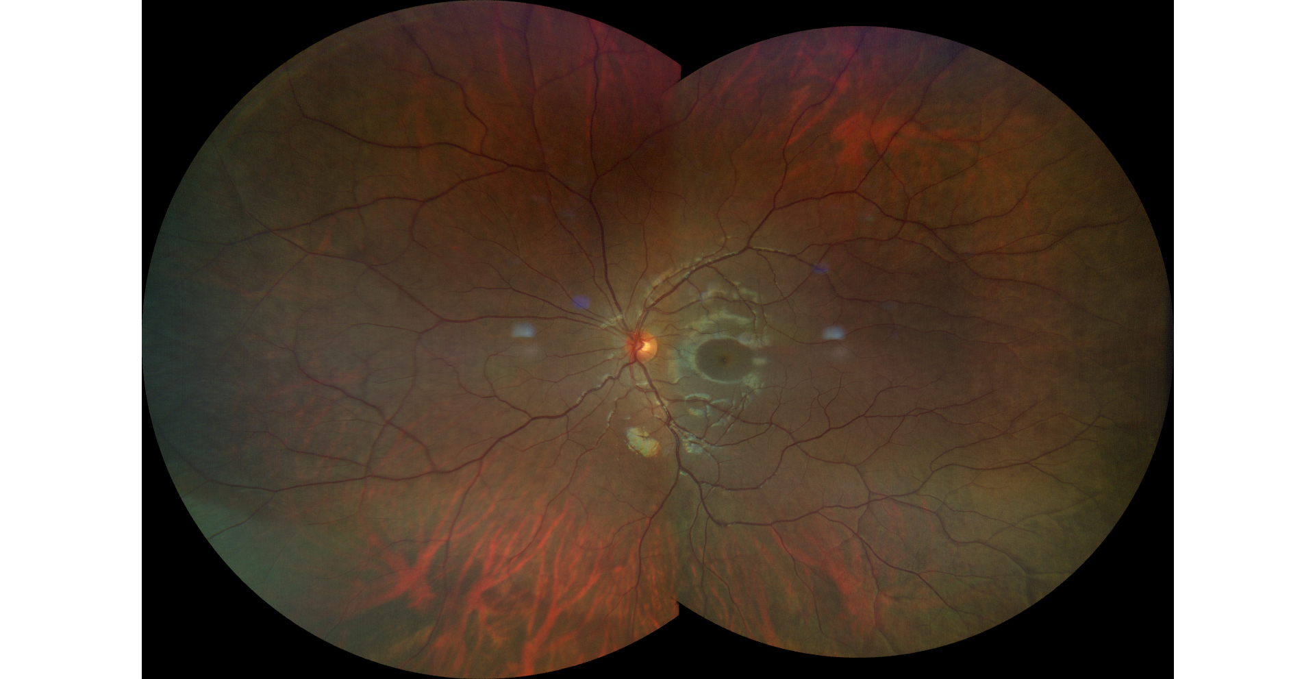 Fundus photo 2