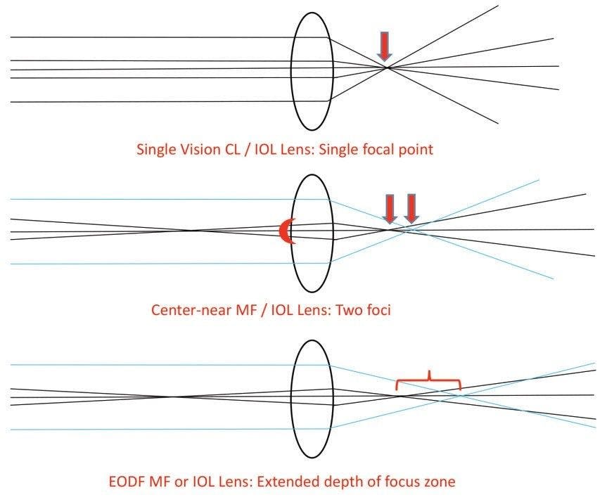 Contact lens foci