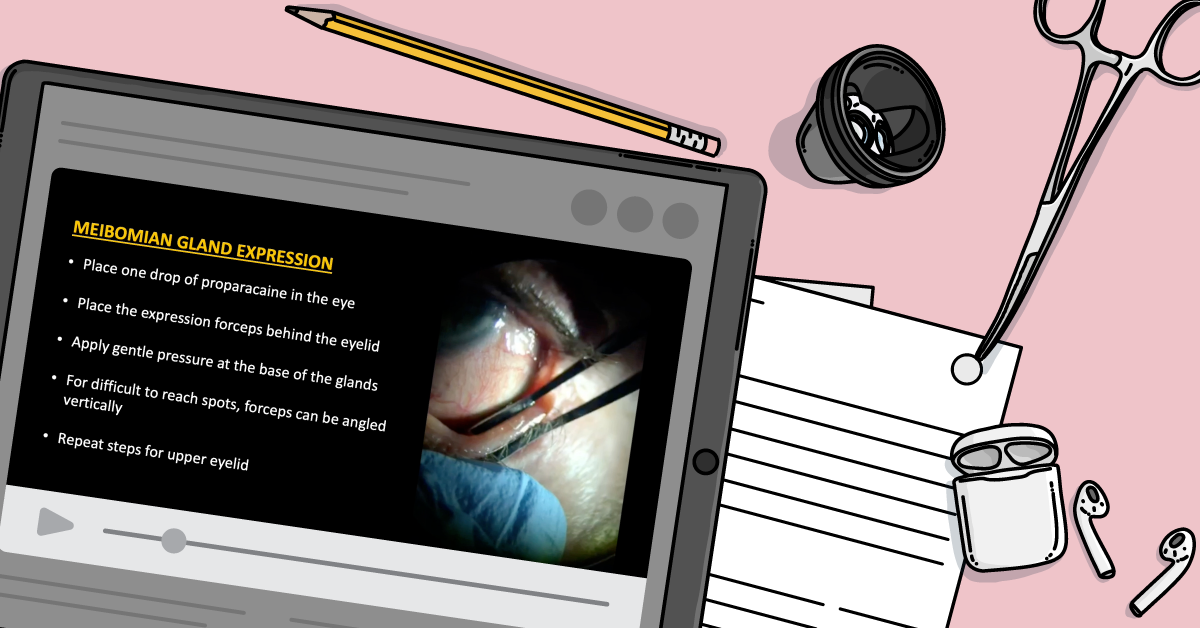 How to Perform Meibomian Gland Expression