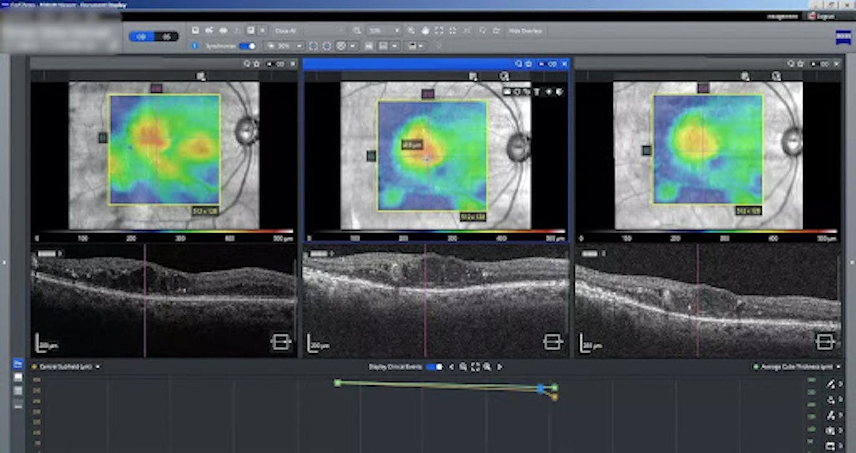 The ZEISS FORUM solution for data management