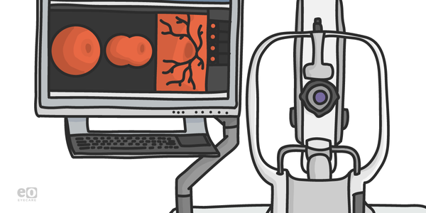 How to Use Ultra-widefield HD 2.0 True Color Imaging in Full-Scope Optometry