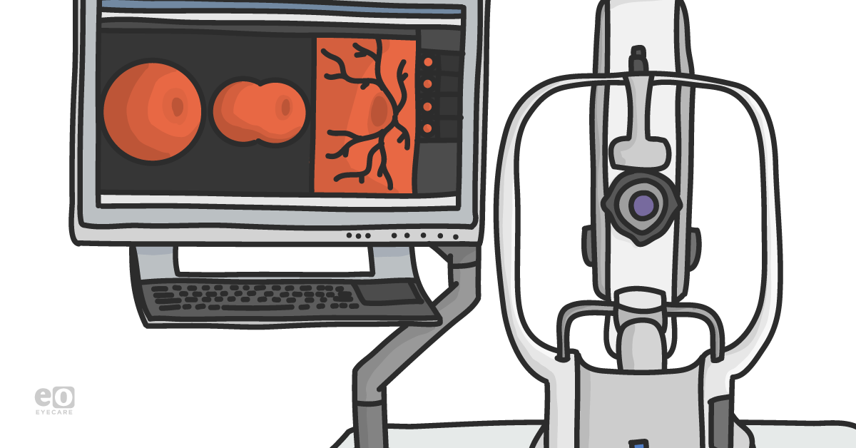 How to Use Ultra-widefield HD 2.0 True Color Imaging in Full-Scope Optometry