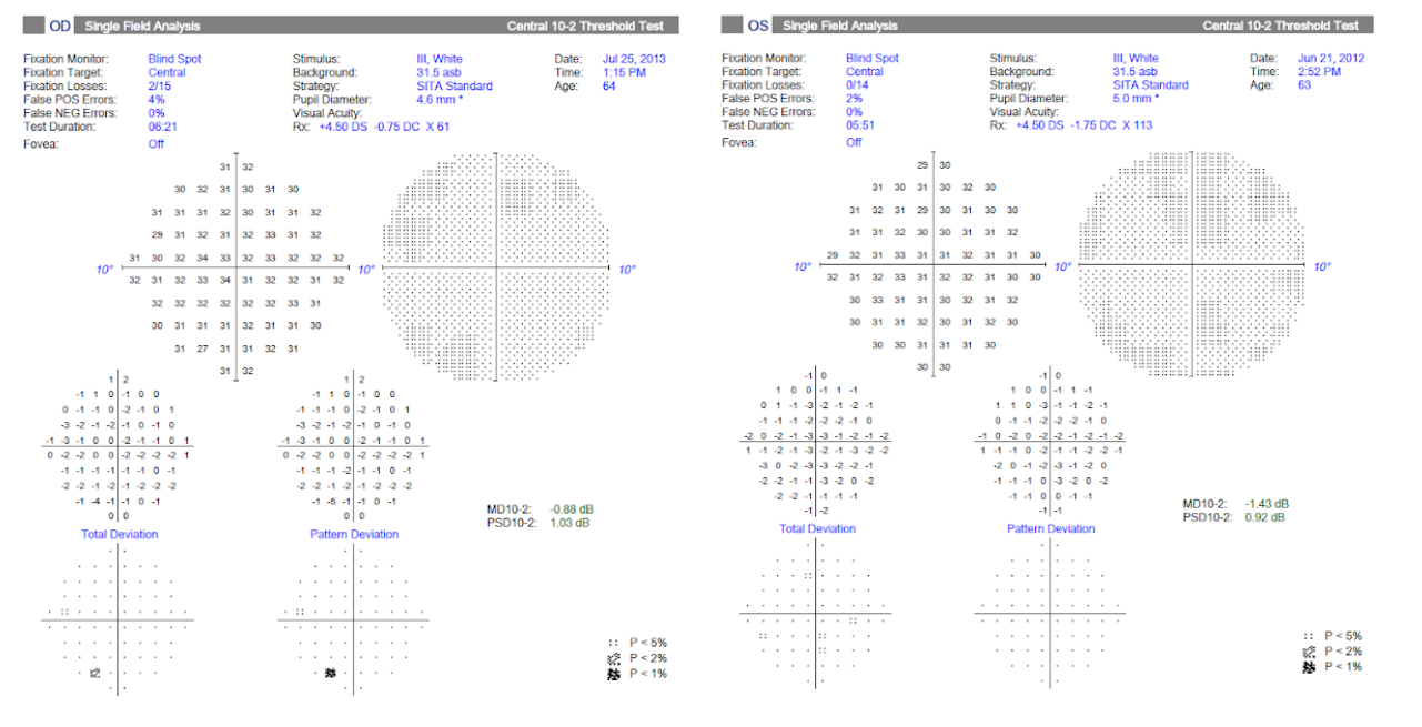 Visual Field Exam 1B.png