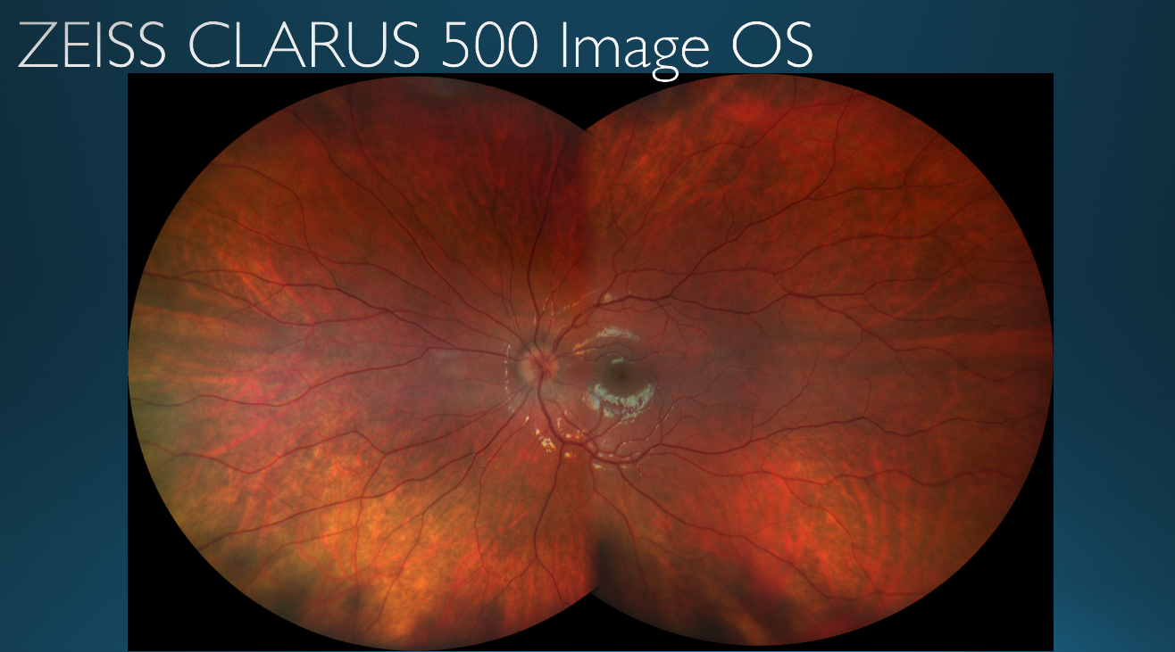 Figure 21 also reveals there is optic nerve pathology in the patient’s left eye