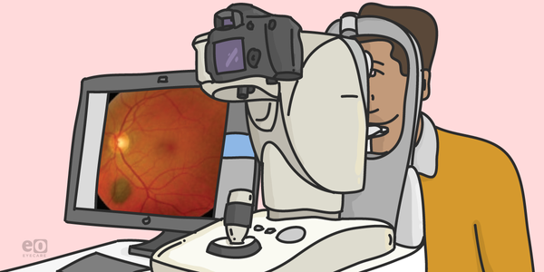 Differential Diagnosis for a Pigmented Fundus Lesion with Downloadable Cheat Sheet