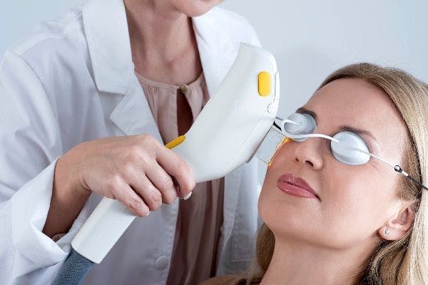 Woman receiving IPL treatment