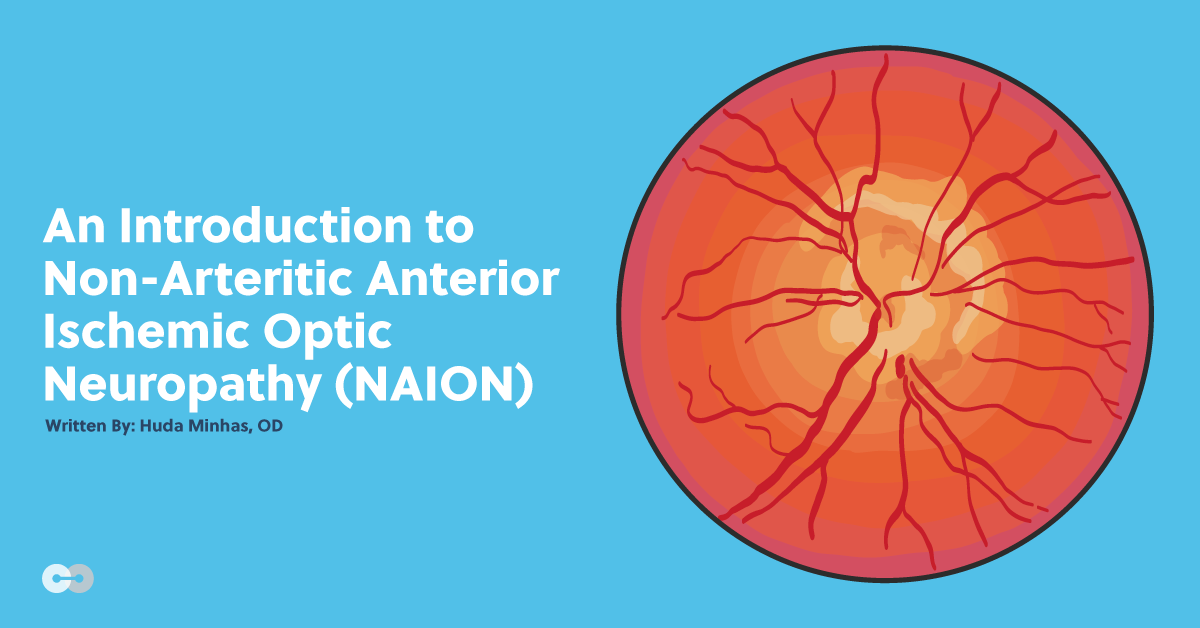 An Introduction to Non-Arteritic Anterior Ischemic Optic Neuropathy (NAION)