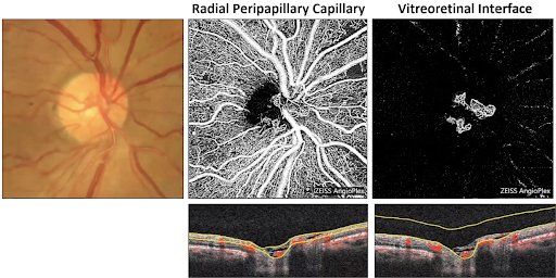 Outline of the Vasculature