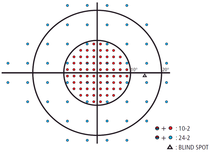 Right eye visual field