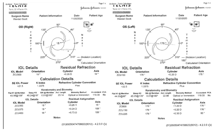 scott_case_3_figure_6_jjv_astigmatism.png