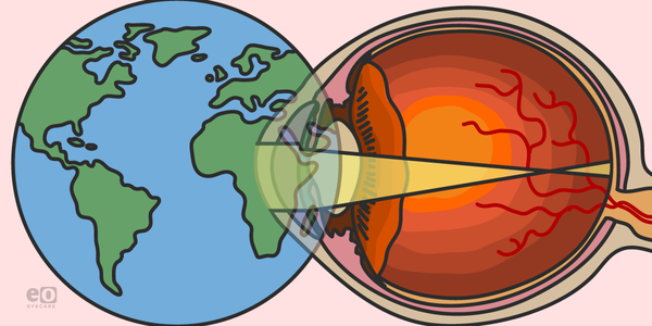 Myopia Awareness and the Evolving Myopigenic Landscape