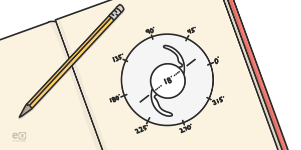 Astigmatism Management in Cataract Surgery