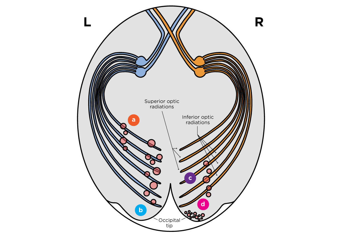 Visual pathways