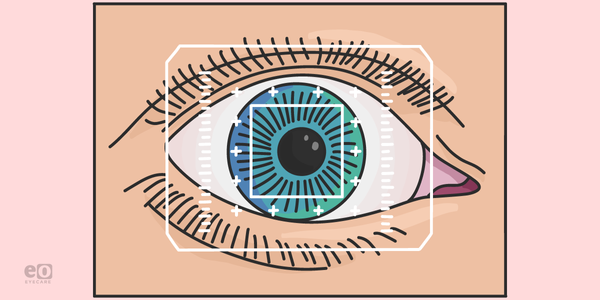 My Top 5 Clinical Pearls for Femtosecond Laser Cataract Surgery