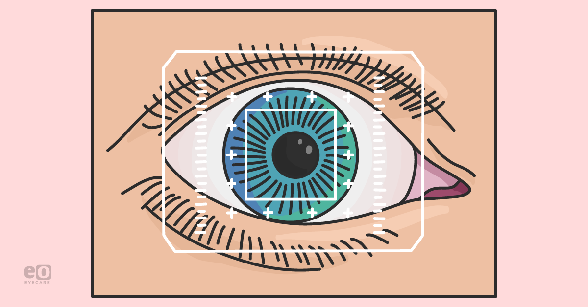 My Top 5 Clinical Pearls for Femtosecond Laser Cataract Surgery