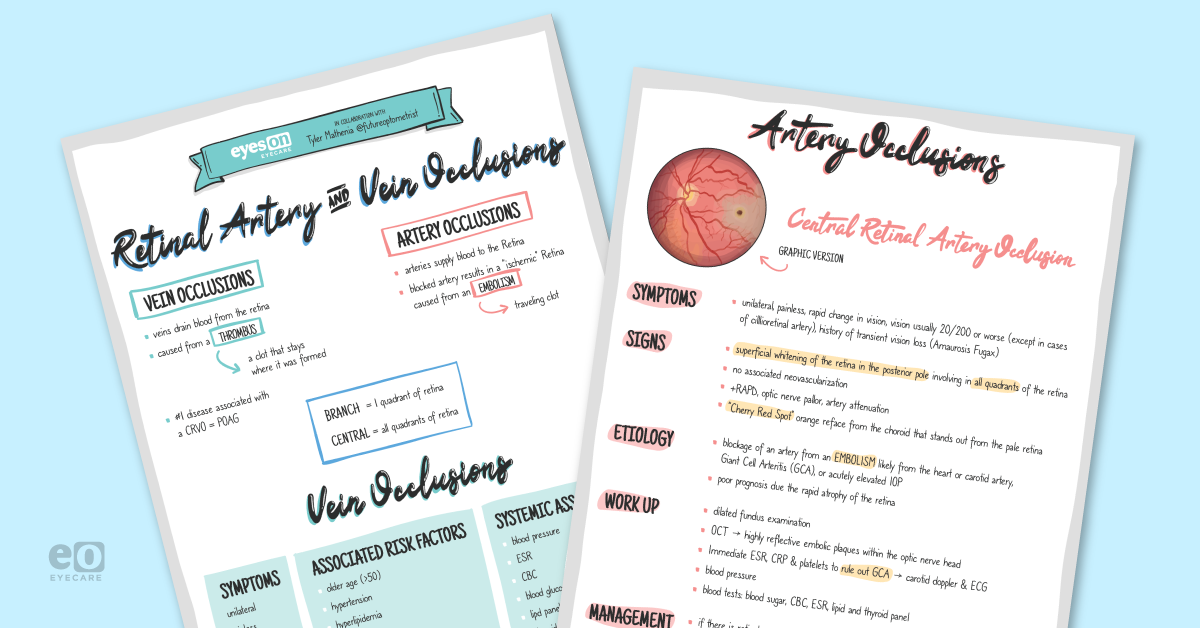 Retinal Artery and Vein Occlusions: Downloadable Study Guide