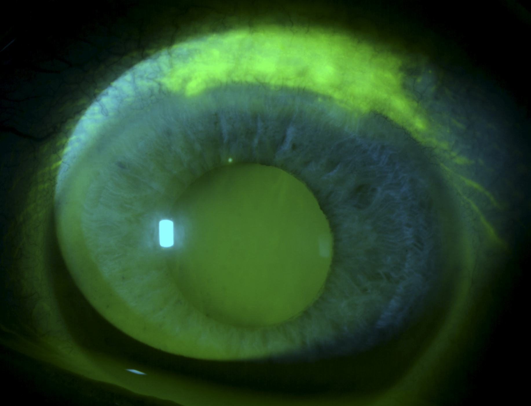 NaFl and LG staining