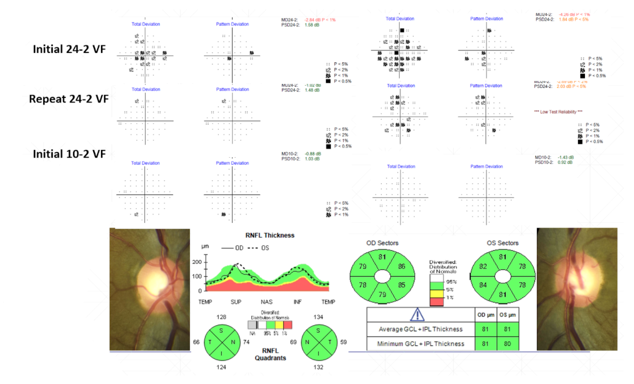 Repeat Visual Field Results.png