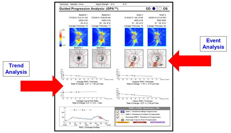 Figure 3. Trend analysis and event analysis in RNFL GPA.