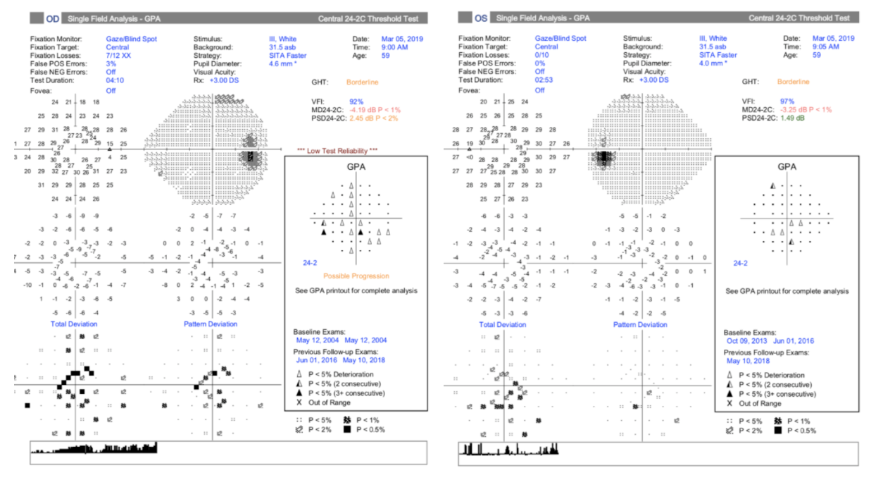 gp patient case hfa vf report.png