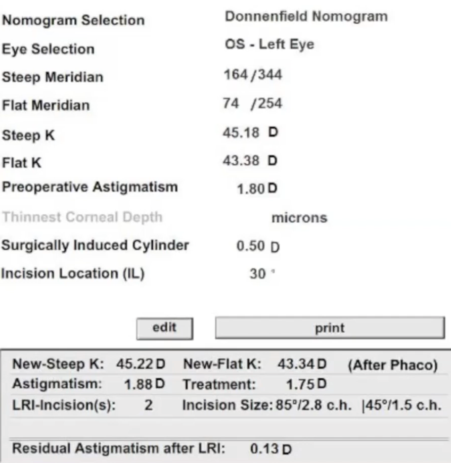 Donnenfeld Nomogram Results