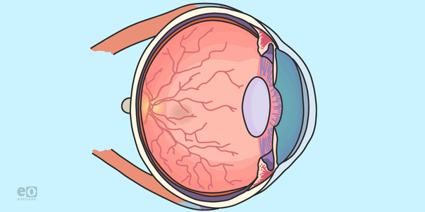 The Role of Macular Pigment Optical Density in Ocular Health