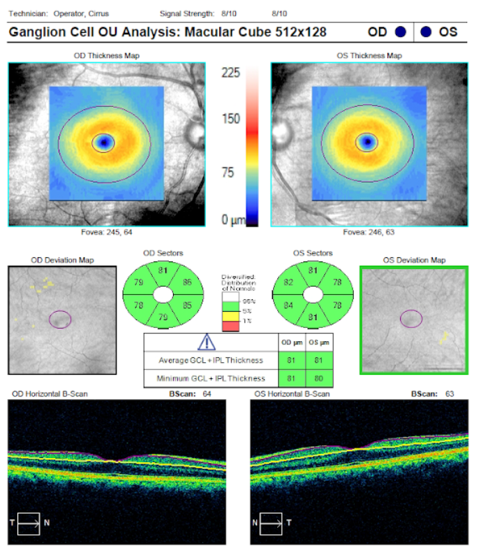 Ganglion Analysis 1.png