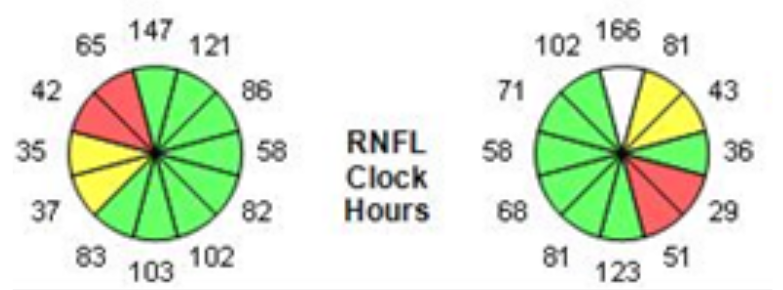 OCT RNFL Clock Hours