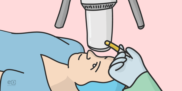 Epithelium-off or Epithelium-on? A Comparative Guide to Corneal Cross-Linking