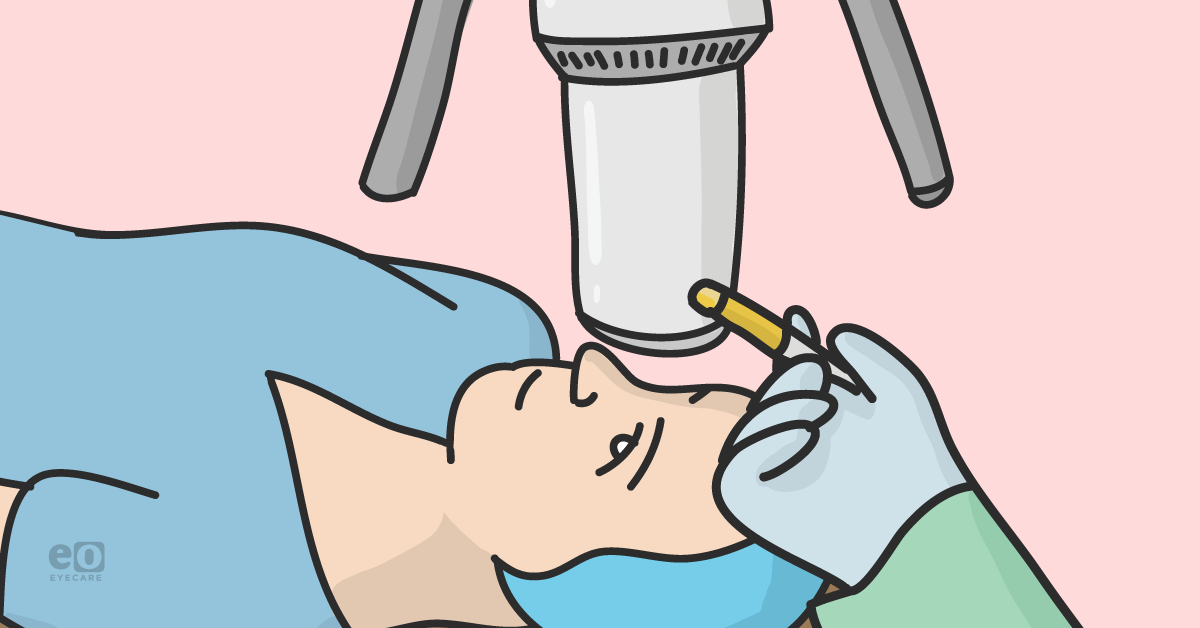 Epithelium-off or Epithelium-on? A Comparative Guide to Corneal Cross-Linking