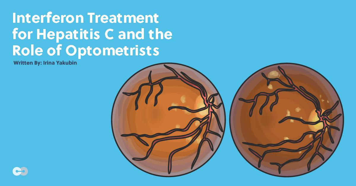 Interferon Treatment for Hepatitis C and the Role of Optometrists