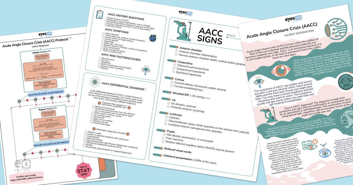 Acute Angle Closure Crisis Protocol with Cheat Sheet