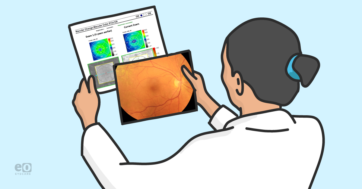 Managing Hydroxychloroquine Retinopathy in High-Risk Patients: A Case Report