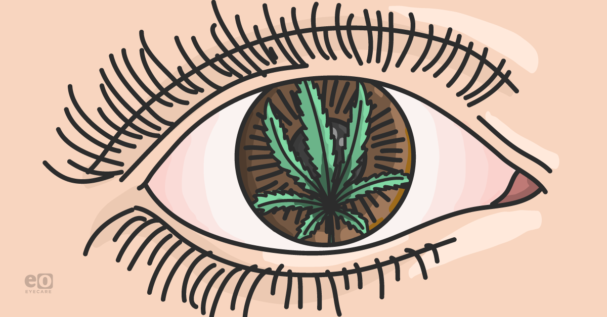 THC, CBD, & IOP: Marijuana as a Treatment for Glaucoma