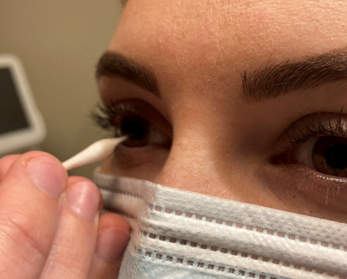 Corneal Sensitivity Testing