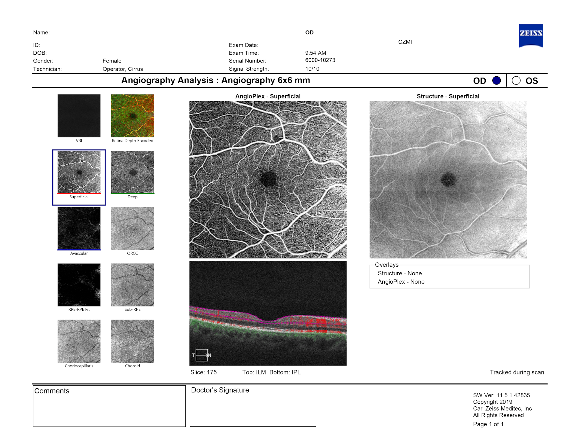 Angiography analysis